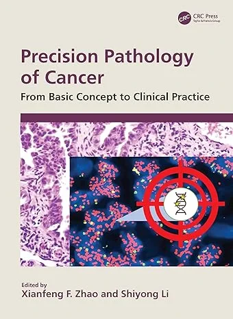 Coperta cărții "Precision Pathology of Cancer: From Basic Concept to Clinical Practice" de autor necunoscut