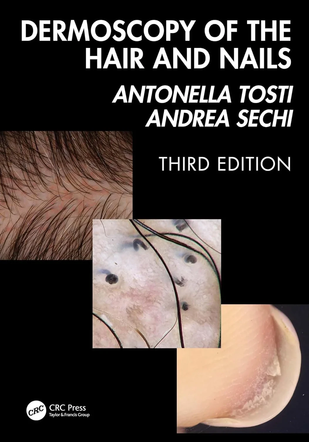 Coperta cărții "Dermoscopy of the Hair and Nails 3e" de autor necunoscut