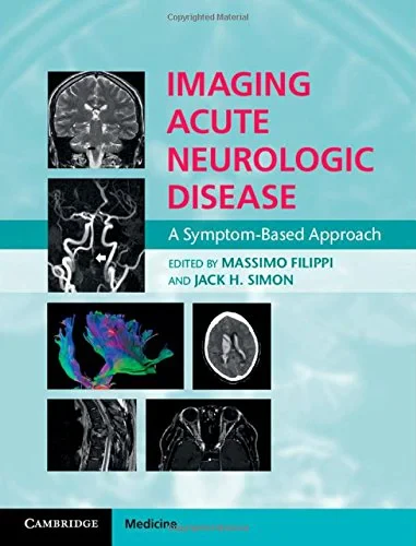 Coperta cărții "Imaging Acute Neurologic Disease: A Symptom-Based Approach" de autor necunoscut
