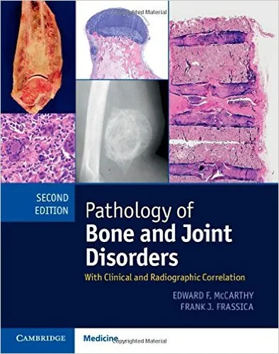 Coperta cărții "Pathology of Bone and Joint Disorders Print and Online Bundle: With Clinical and Radiographic Correlation 2nd Edition" de autor necunoscut