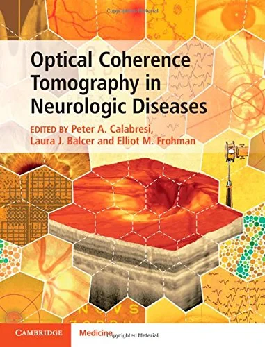 Coperta cărții "Optical Coherence Tomography in Neurologic Diseases" de autor necunoscut