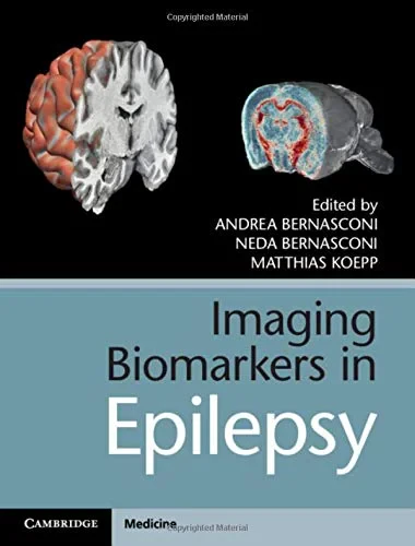 Coperta cărții "Imaging Biomarkers in Epilepsy" de autor necunoscut