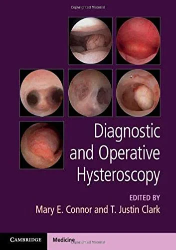 Coperta cărții "Diagnostic and Operative Hysteroscopy" de autor necunoscut