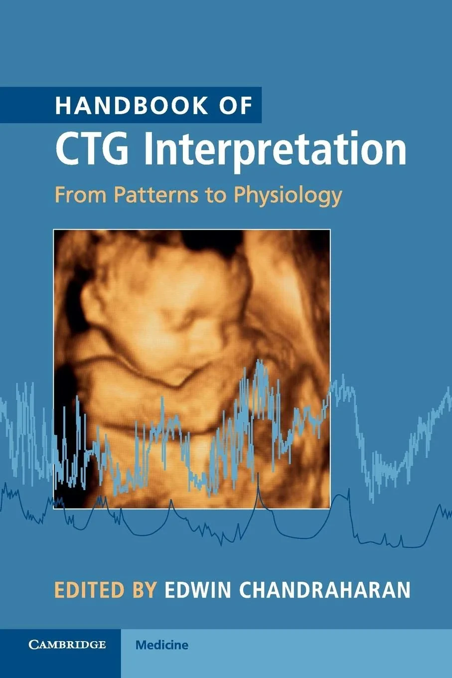 Coperta cărții "Handbook of CTG Interpretation: From Patterns to Physiology" de autor necunoscut