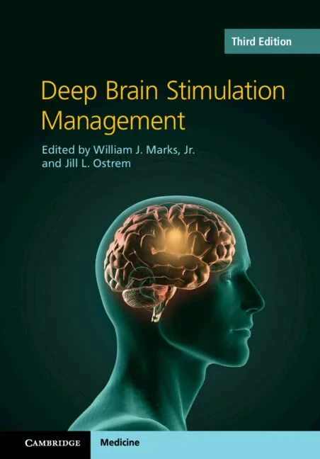 Coperta cărții "Deep Brain Stimulation Management" de autor necunoscut