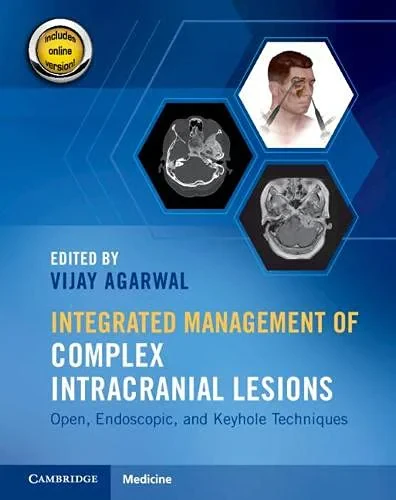 Coperta cărții "Integrated Management of Complex Intracranial Lesions" de autor necunoscut
