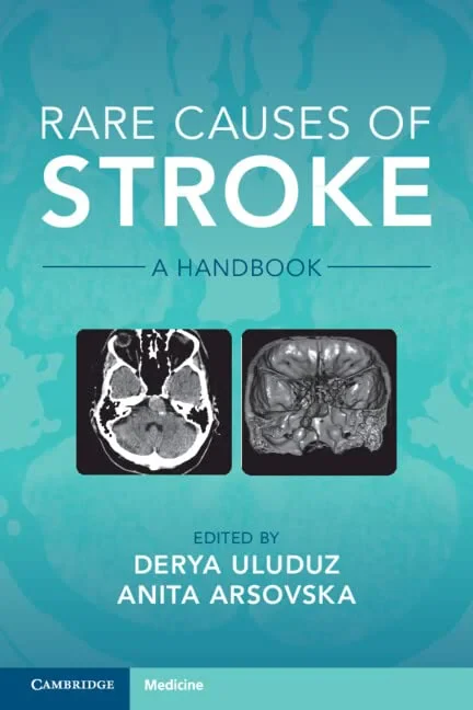 Coperta cărții "Rare Causes of Stroke: A Handbook" de autor necunoscut
