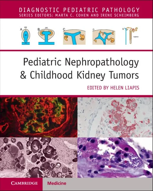Coperta cărții "Pediatric Nephropathology &amp; Childhood Kidney Tumors with Online Resource" de autor necunoscut