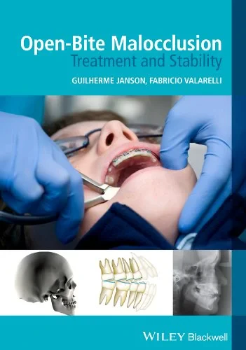 Coperta cărții "Open&amp;#150;Bite Malocclusion &amp;#150; Treatment and Stability" de autor necunoscut