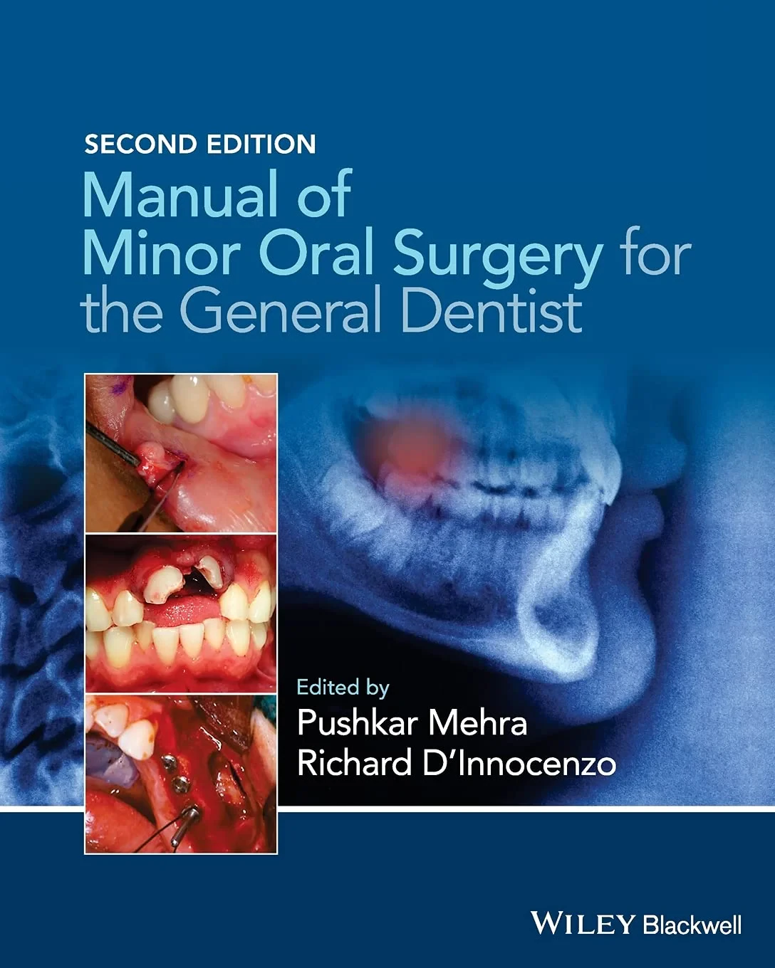 Coperta cărții "Manual of Minor Oral Surgery for the General Dentist" de autor necunoscut