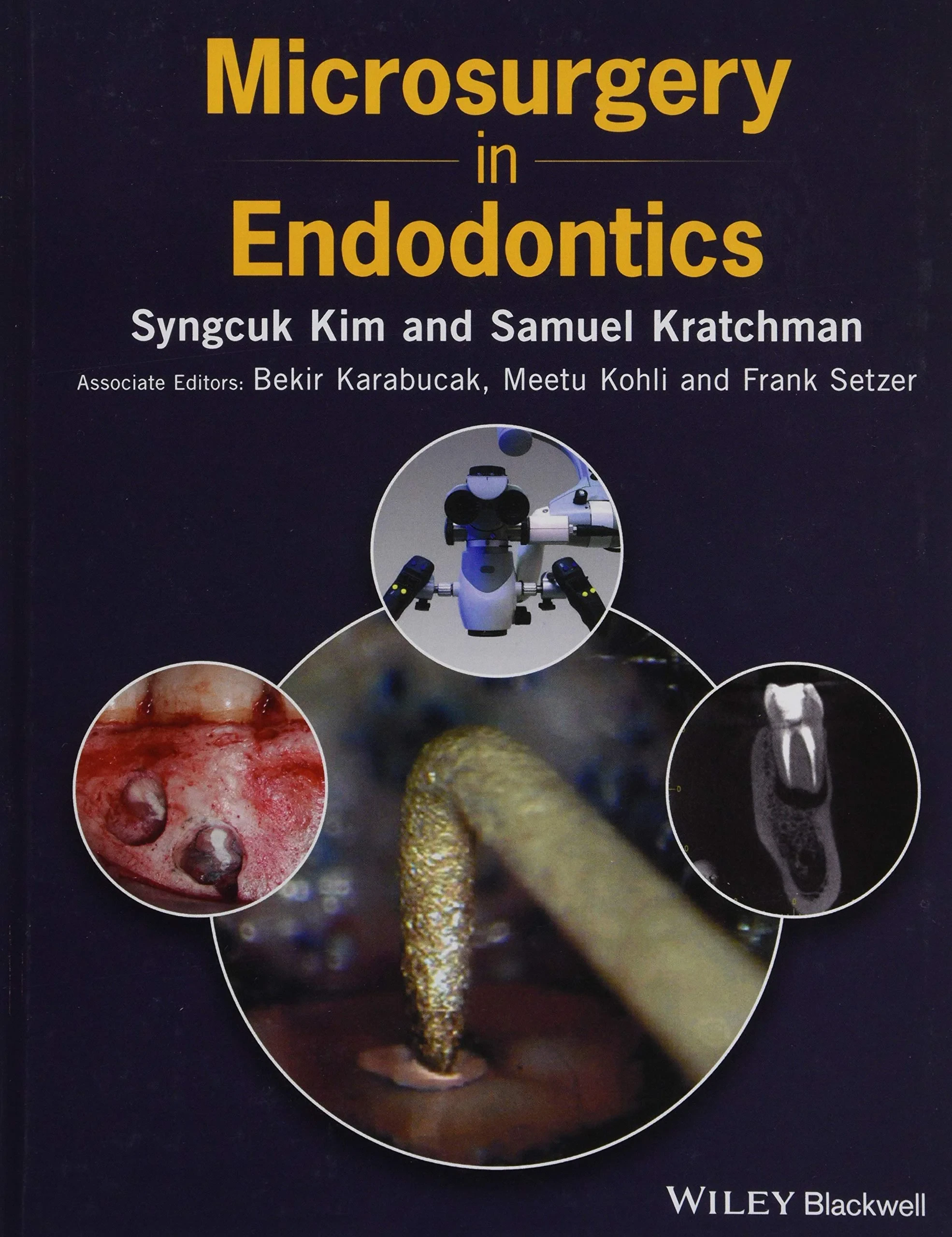 Coperta cărții "Microsurgery in Endodontics" de autor necunoscut