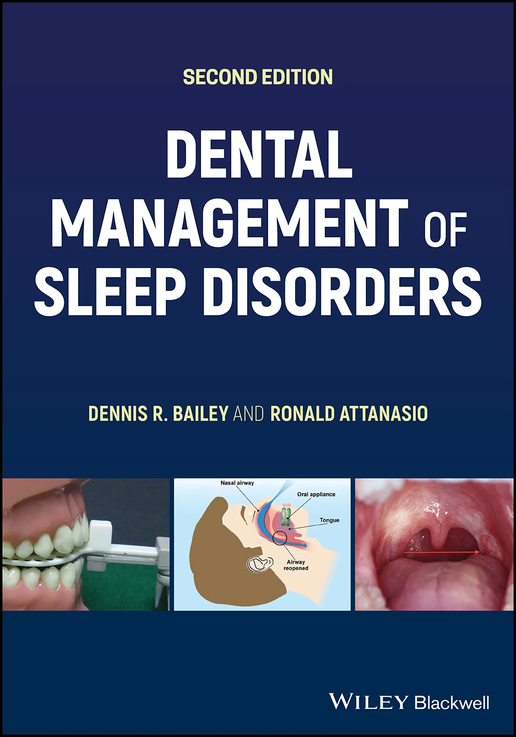 Coperta cărții "Dental Management of Sleep Disorders" de autor necunoscut