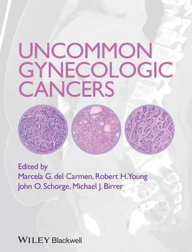 Coperta cărții "Uncommon Gynecologic Cancers" de autor necunoscut