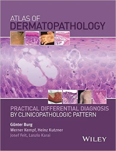 Coperta cărții "Atlas of Dermatopathology: Practical Differential Diagnosis by Clinicopathologic Pattern 1st Edition" de autor necunoscut