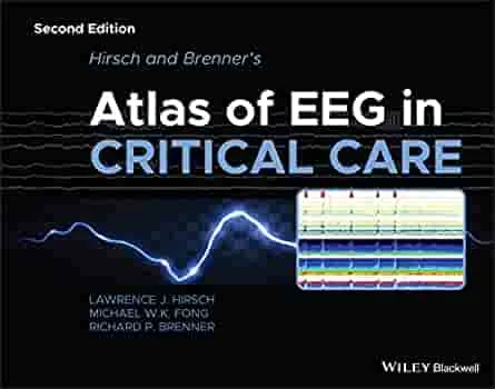 Coperta cărții "Hirsch and Brenner′s Atlas of EEG in Critical Care , 2nd Edition" de autor necunoscut