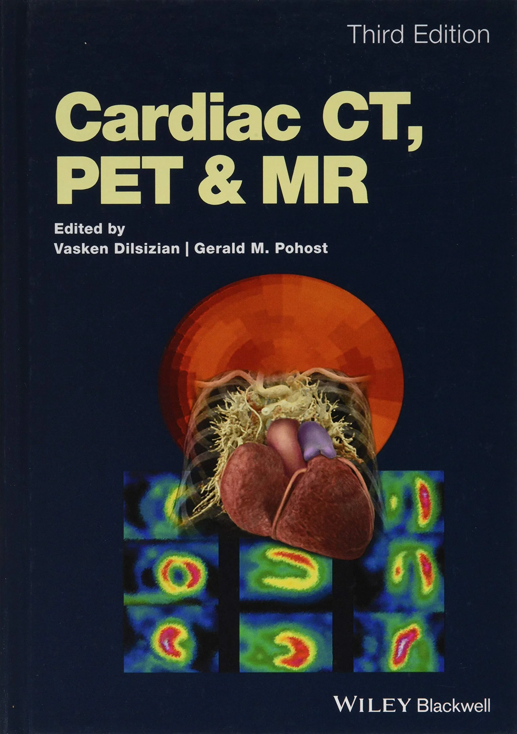 Coperta cărții "Cardiac CT, PET and MR" de autor necunoscut