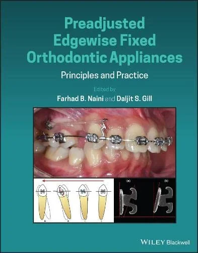 Coperta cărții "Preadjusted Edgewise Fixed Orthodontic Appliances: Principles and Practice" de autor necunoscut