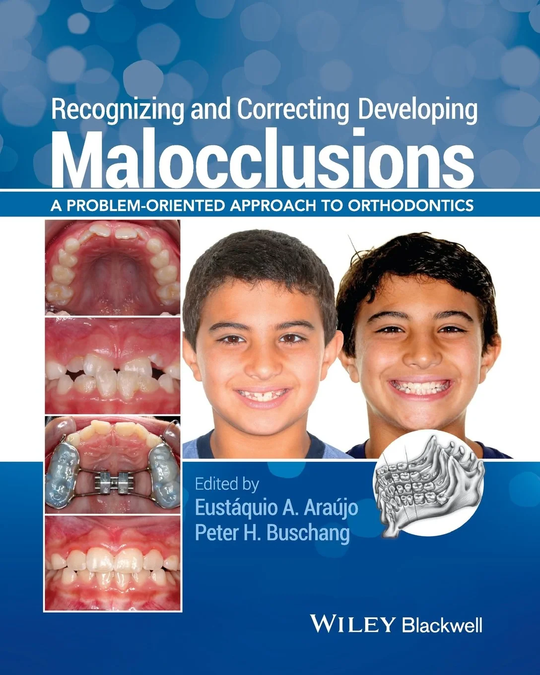 Coperta cărții "Recognizing and Correcting Developing Malocclusions: A Problem-Oriented Approach to Orthodontics" de autor necunoscut