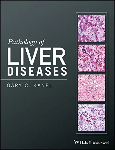 Coperta cărții "Pathology of Liver Diseases" de autor necunoscut