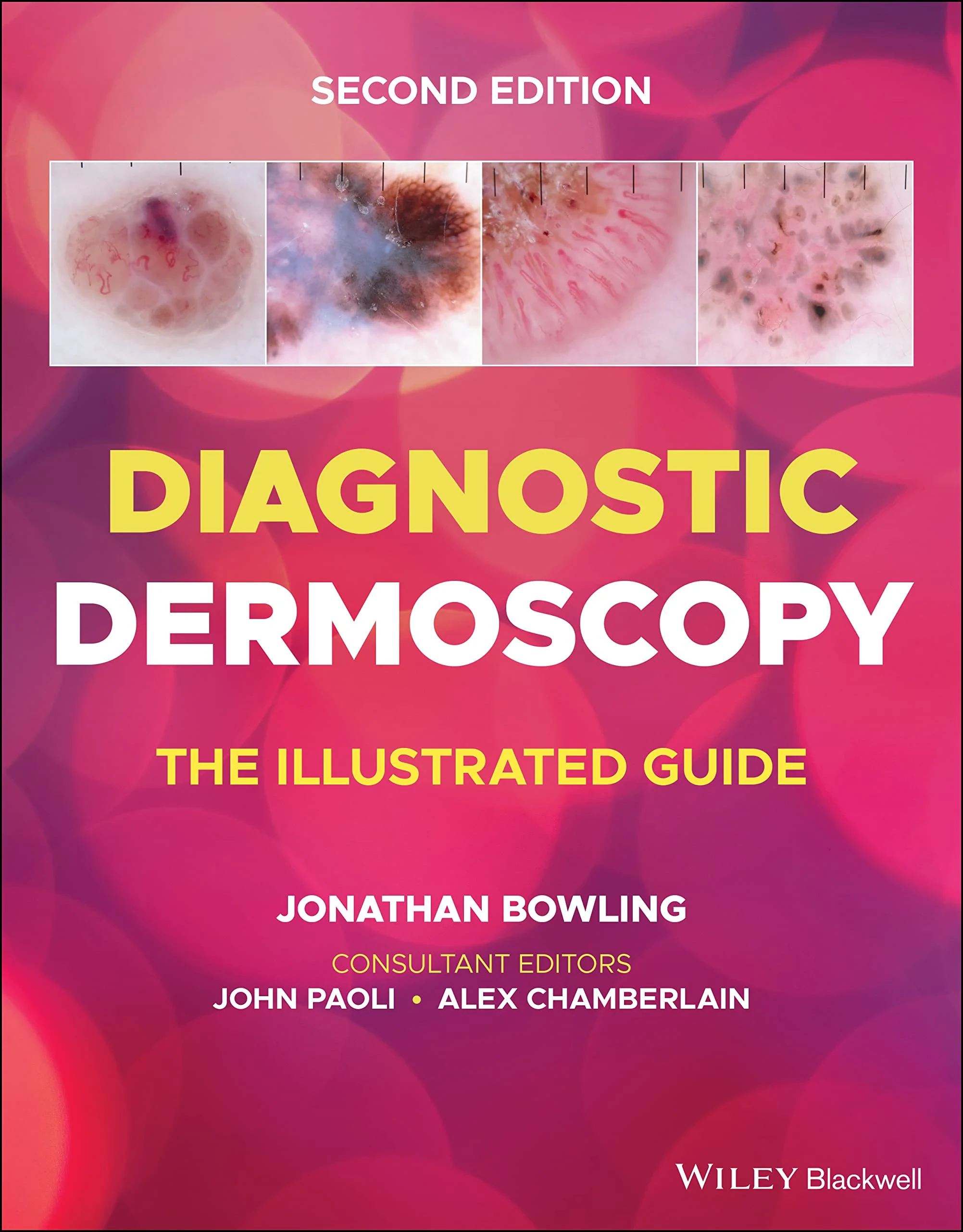 Coperta cărții "Diagnostic Dermoscopy &amp;#150; The Illustrated Guide, 2e" de autor necunoscut