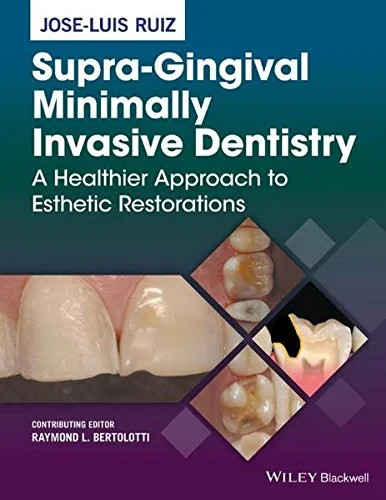 Coperta cărții "Supra-Gingival Minimally Invasive Dentistry: A Healthier Approach to Esthetic Restorations" de autor necunoscut