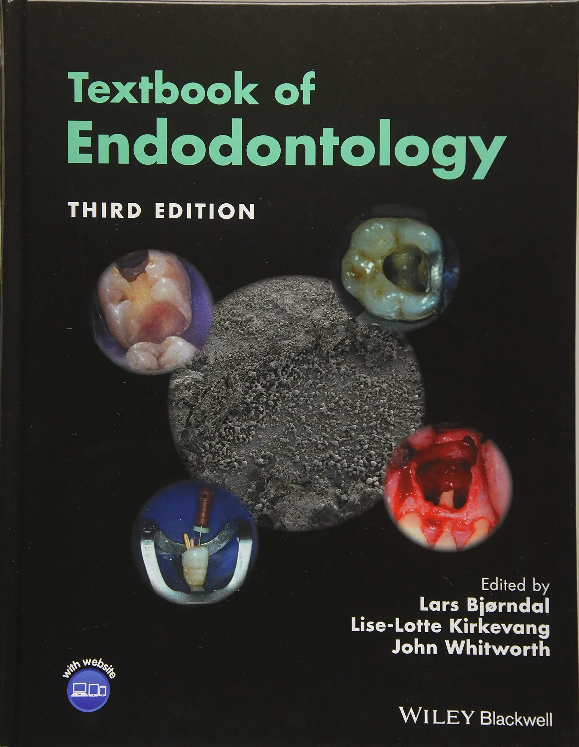 Coperta cărții "Textbook of Endodontology" de autor necunoscut