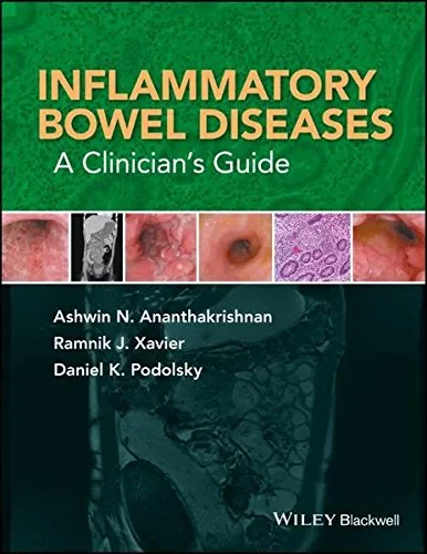 Coperta cărții "Inflammatory Bowel Diseases: A Clinician&amp;#146;s Guide" de autor necunoscut