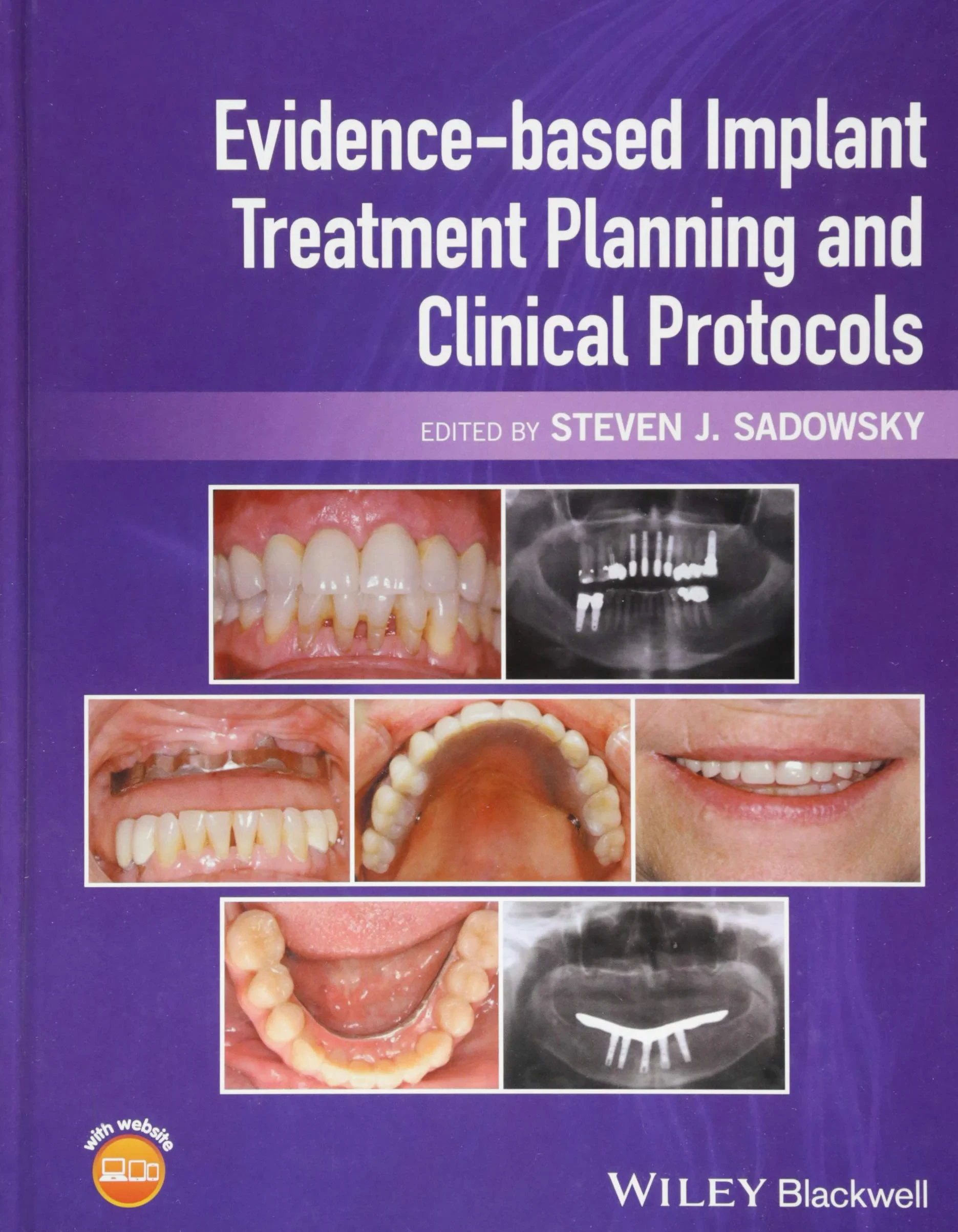 Coperta cărții "Evidence-Based Implant Treatment Planning and Clinical Protocols" de autor necunoscut
