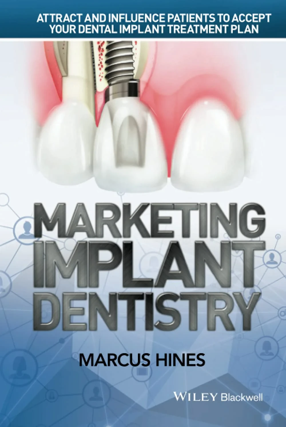 Coperta cărții "Marketing Implant Dentistry" de autor necunoscut