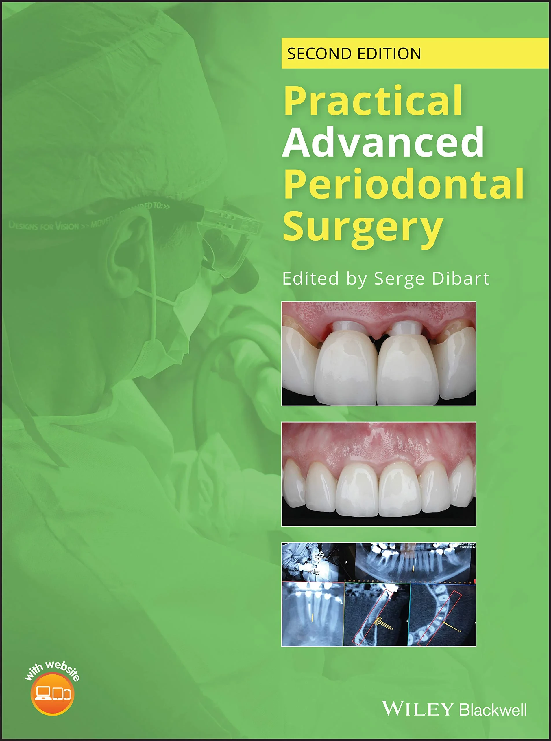 Coperta cărții "Practical Advanced Periodontal Surgery" de autor necunoscut