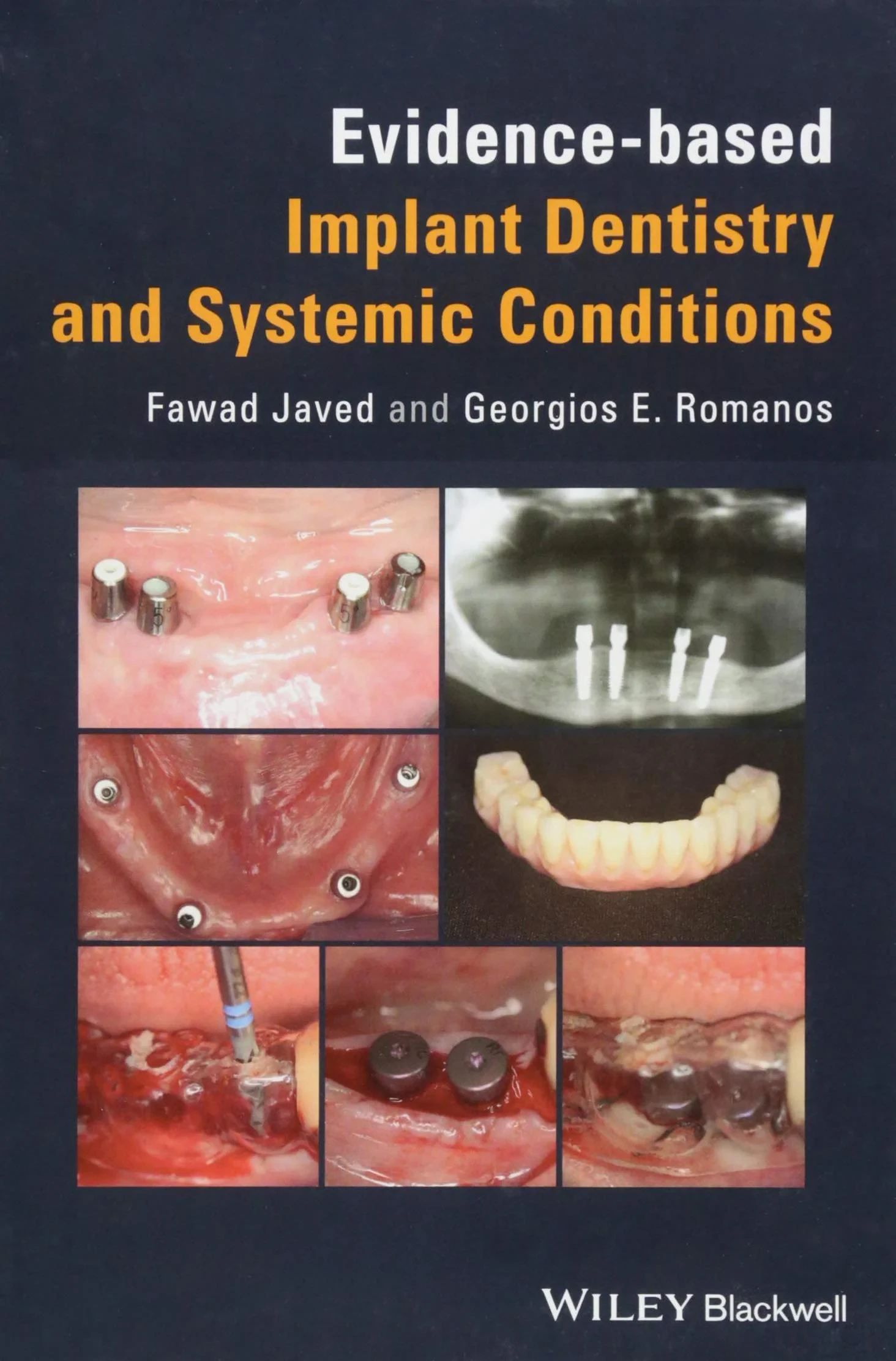 Coperta cărții "Evidence&amp;#150;based Implant Dentistry and Systemic Conditions" de autor necunoscut