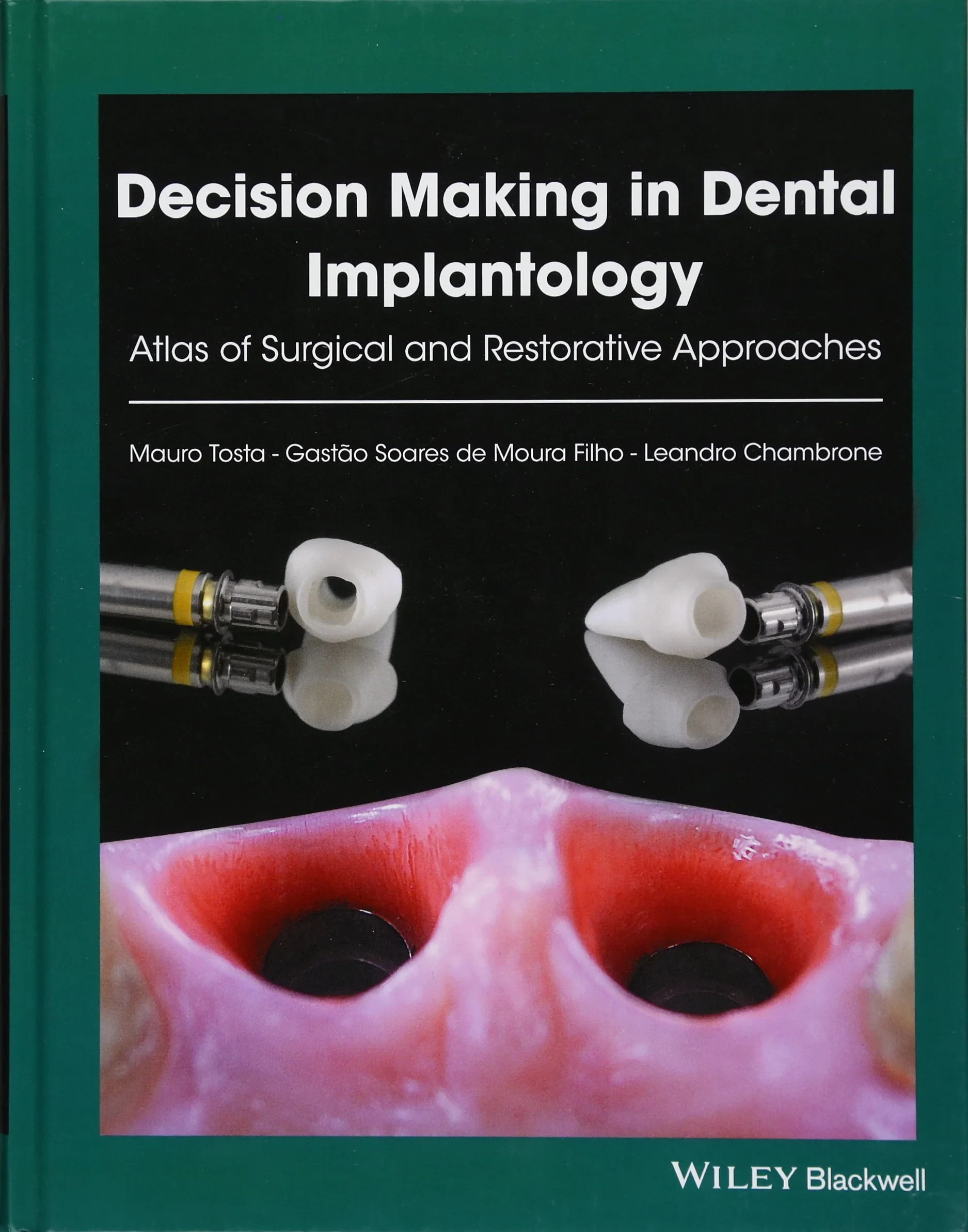 Coperta cărții "Decision Making in Dental Implantology: Atlas of Surgical and Restorative Approaches" de autor necunoscut