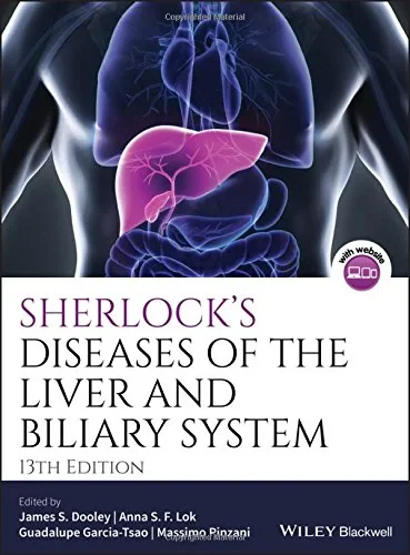 Coperta cărții "Sherlock&amp;#146;s Diseases of the Liver and Biliary System" de autor necunoscut