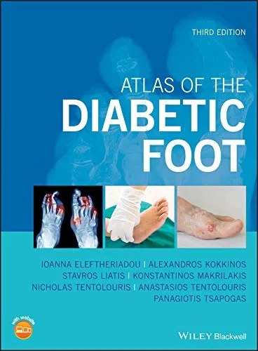 Coperta cărții "Atlas of the Diabetic Foot" de autor necunoscut