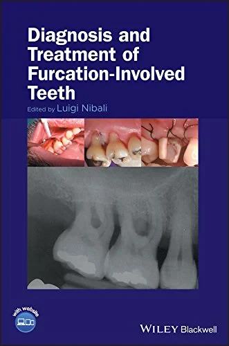 Coperta cărții "Diagnosis and Treatment of Furcation-Involved Teeth" de autor necunoscut