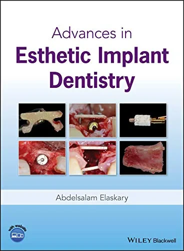 Coperta cărții "Advances in Esthetic Implant Dentistry" de autor necunoscut