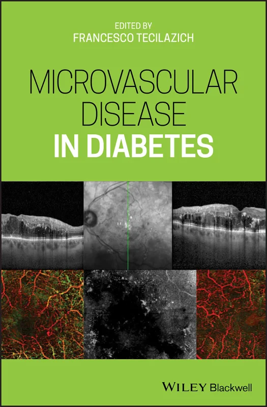 Coperta cărții "Microvascular Disease in Diabetes" de autor necunoscut