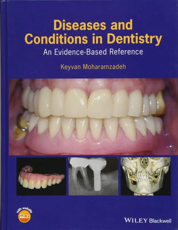 Coperta cărții "Diseases and Conditions in Dentistry: An Evidence&amp;#150;Based Reference" de autor necunoscut