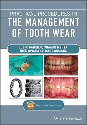 Coperta cărții "Practical Procedures in the Management of Tooth Wear" de autor necunoscut