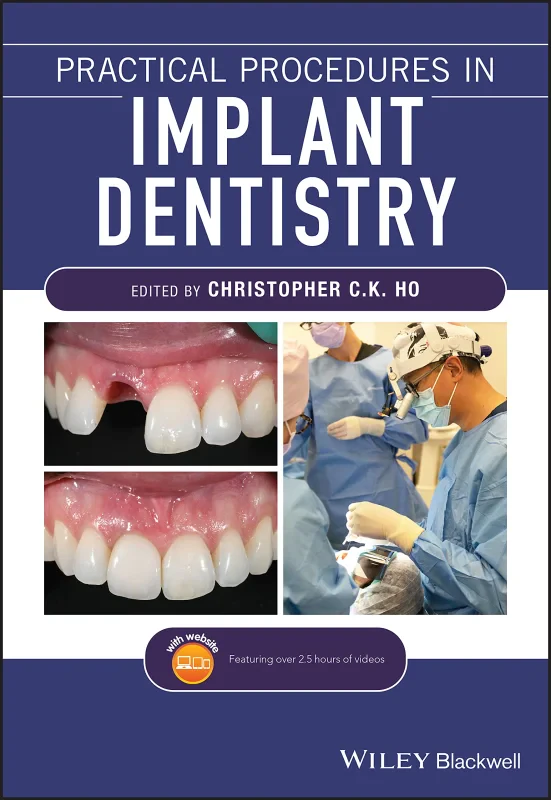 Coperta cărții "Practical Procedures in Implant Dentistry" de autor necunoscut