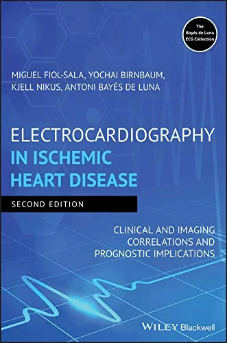 Coperta cărții "Electrocardiography in Ischemic Heart Disease: Clinical and Imaging Correlations and Prognostic Implications" de autor necunoscut