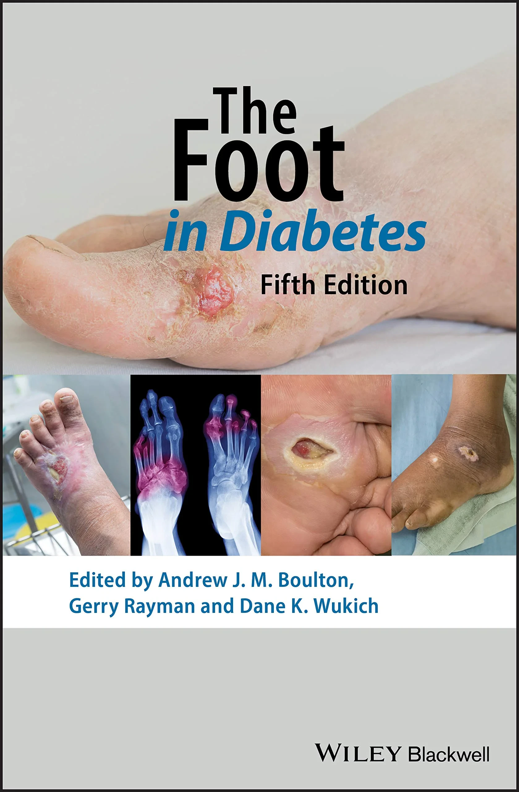Coperta cărții "The Foot in Diabetes" de autor necunoscut