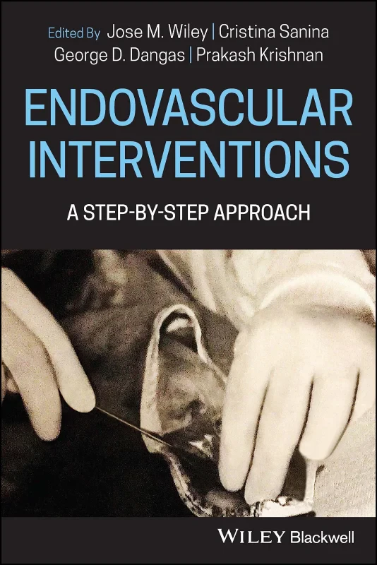 Coperta cărții "Endovascular Procedures A Step&amp;#150;by&amp;#150;Step Approach" de autor necunoscut