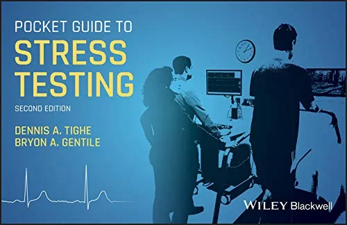 Coperta cărții "Pocket Guide to Stress Testing, 2nd Edition" de autor necunoscut