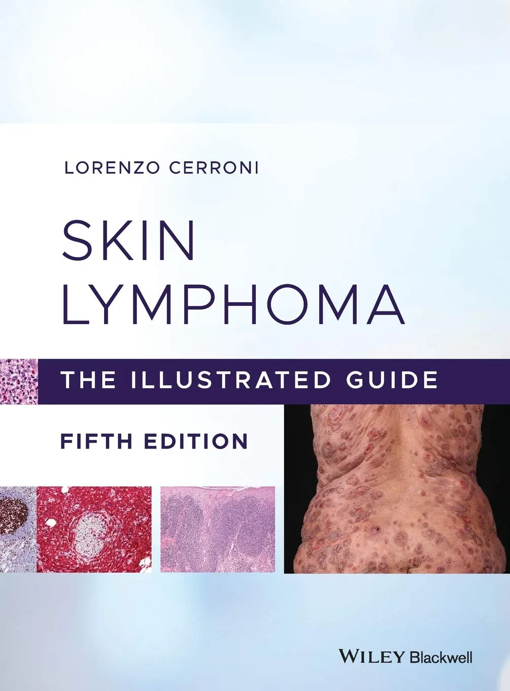 Coperta cărții "Skin Lymphoma: The Illustrated Guide" de autor necunoscut
