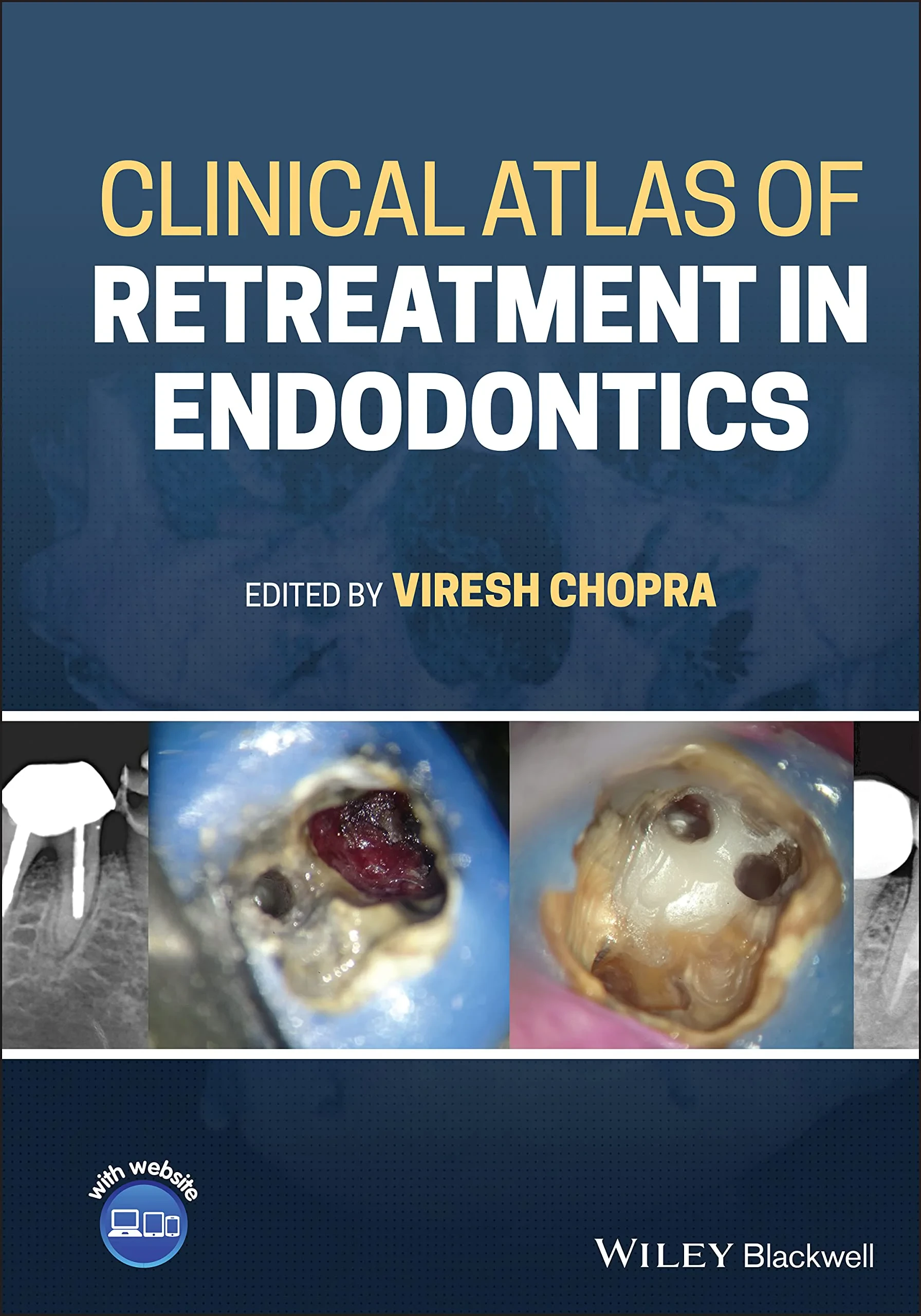 Coperta cărții "Clinical Atlas of Retreatment in Endodontics" de autor necunoscut