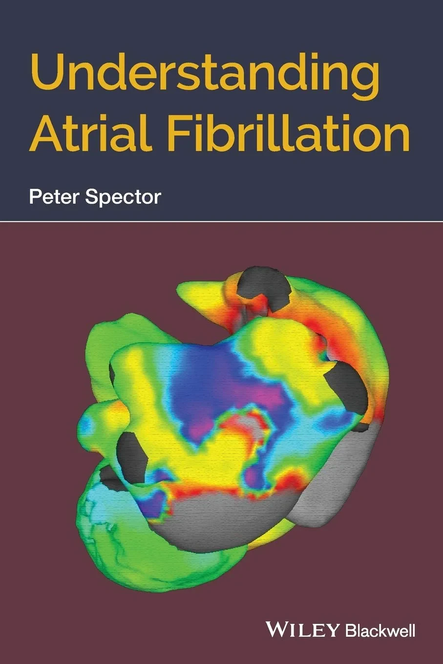 Coperta cărții "Understanding Atrial Fibrillation" de autor necunoscut
