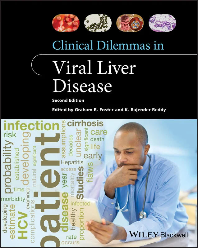 Coperta cărții "Clinical Dilemmas in Viral Liver Disease" de autor necunoscut
