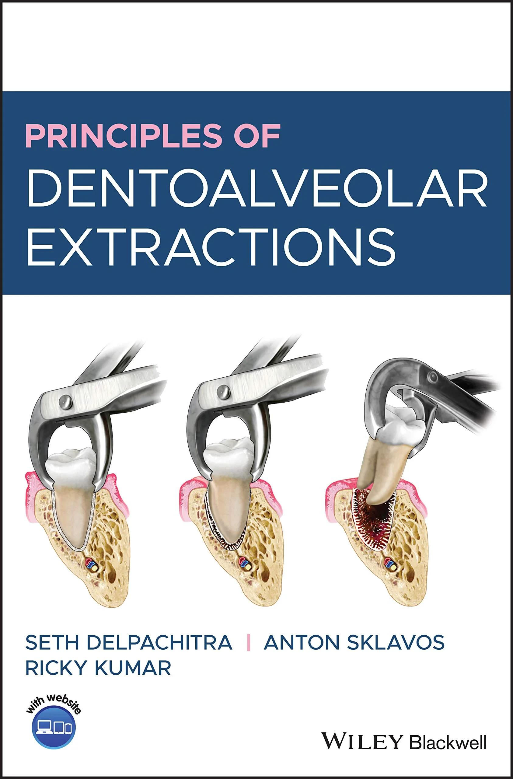 Coperta cărții "Principles of Dentoalveolar Extractions" de autor necunoscut