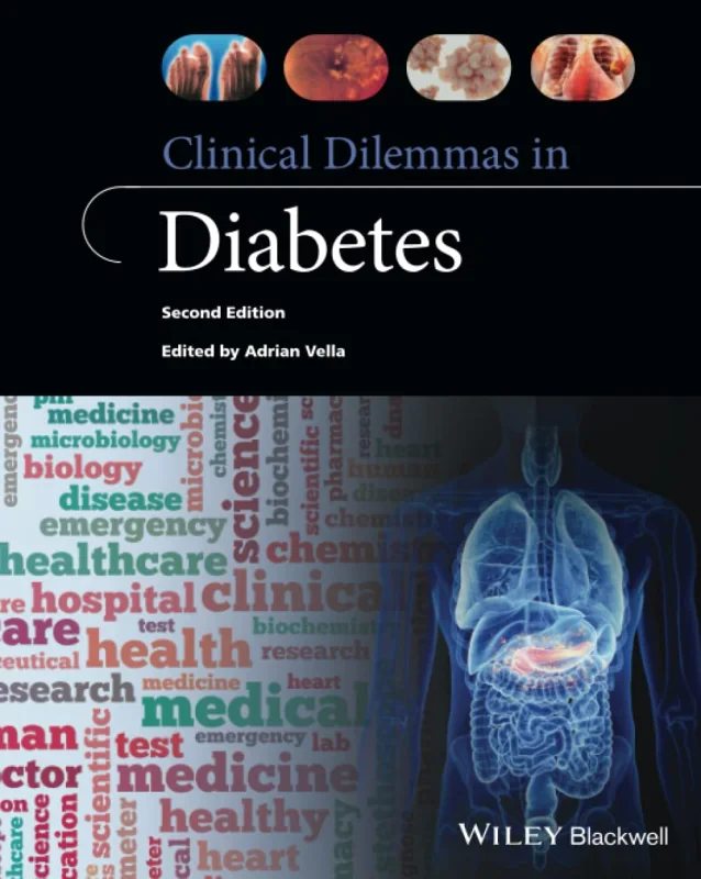 Coperta cărții "Clinical Dilemmas in Diabetes" de autor necunoscut